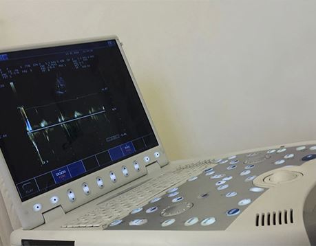 A piece of cardiovascular equipment showing a heart rate on the monitor