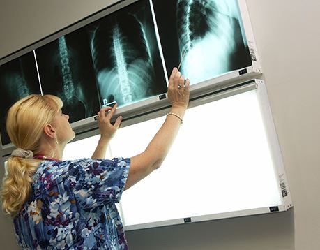 A radiologic technologist studies an x-ray of a torso